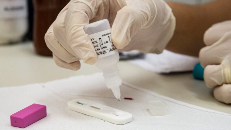 Exposerra oferece testagem para detecção de hepatites virais